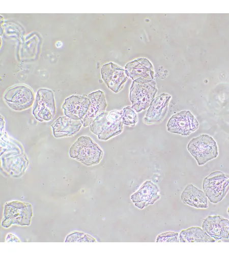 MAGUS SPH2 fazinio kontrasto prietaisas