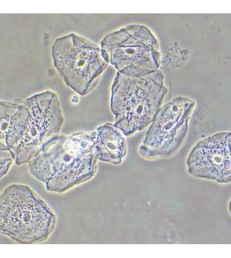 MAGUS SPH2 fazinio kontrasto prietaisas