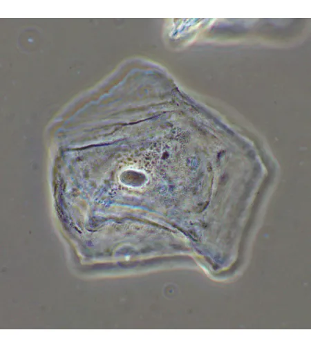 MAGUS SPH2 fazinio kontrasto prietaisas