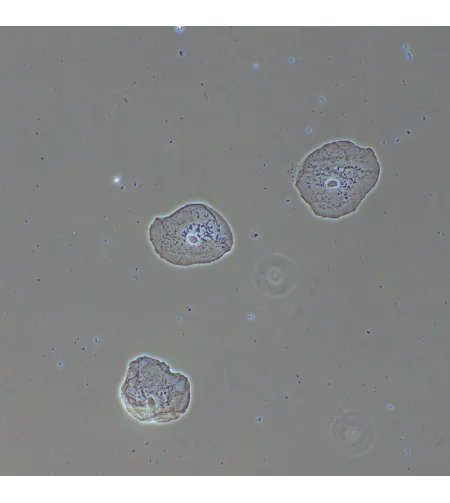 MAGUS PH2 fazinio kontrasto prietaisas