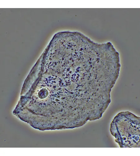 MAGUS PH2 fazinio kontrasto prietaisas