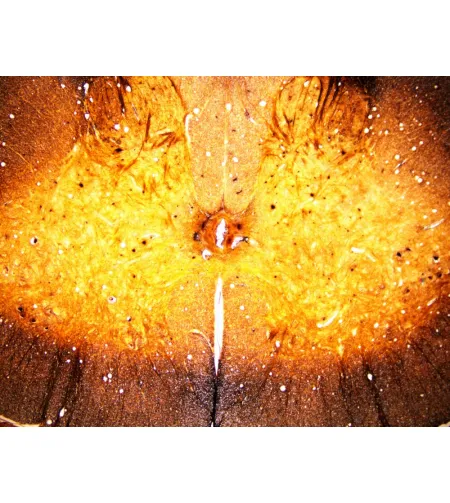 BRESSER Paruoštos skaidrės 25 vnt. Dėžutė