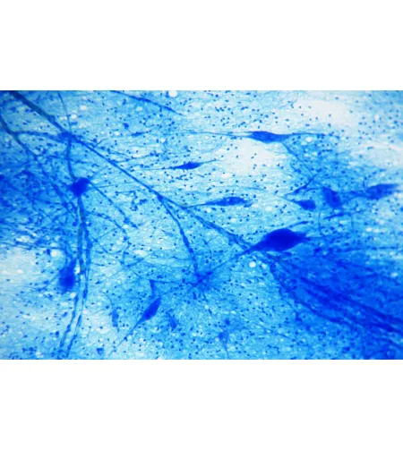 BRESSER Paruoštos skaidrės 25 vnt. Dėžutė