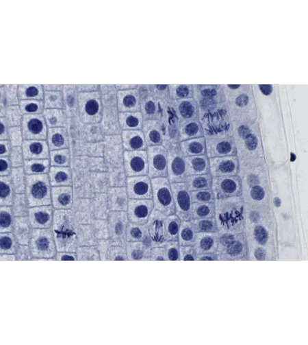 BRESSER paruoštos skaidrės aukštos kokybės 10 vnt