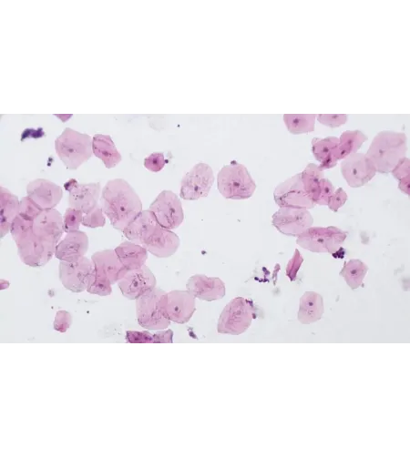 BRESSER paruoštos skaidrės aukštos kokybės 10 vnt